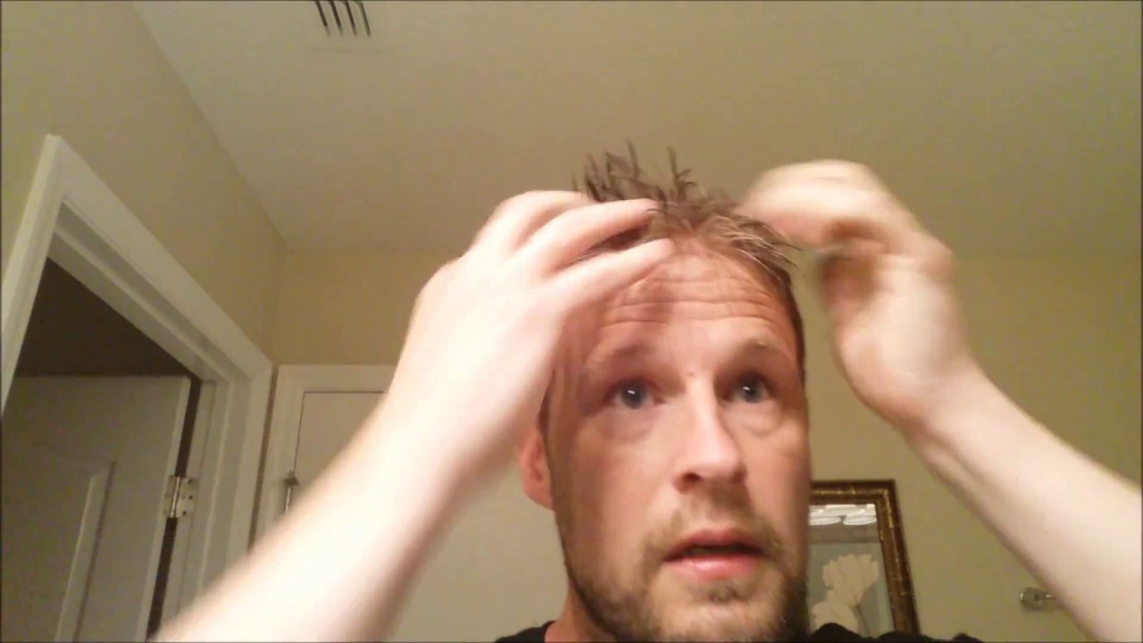 Hair Replacement System, Hairline clean up Tutorial on a lace front hair system