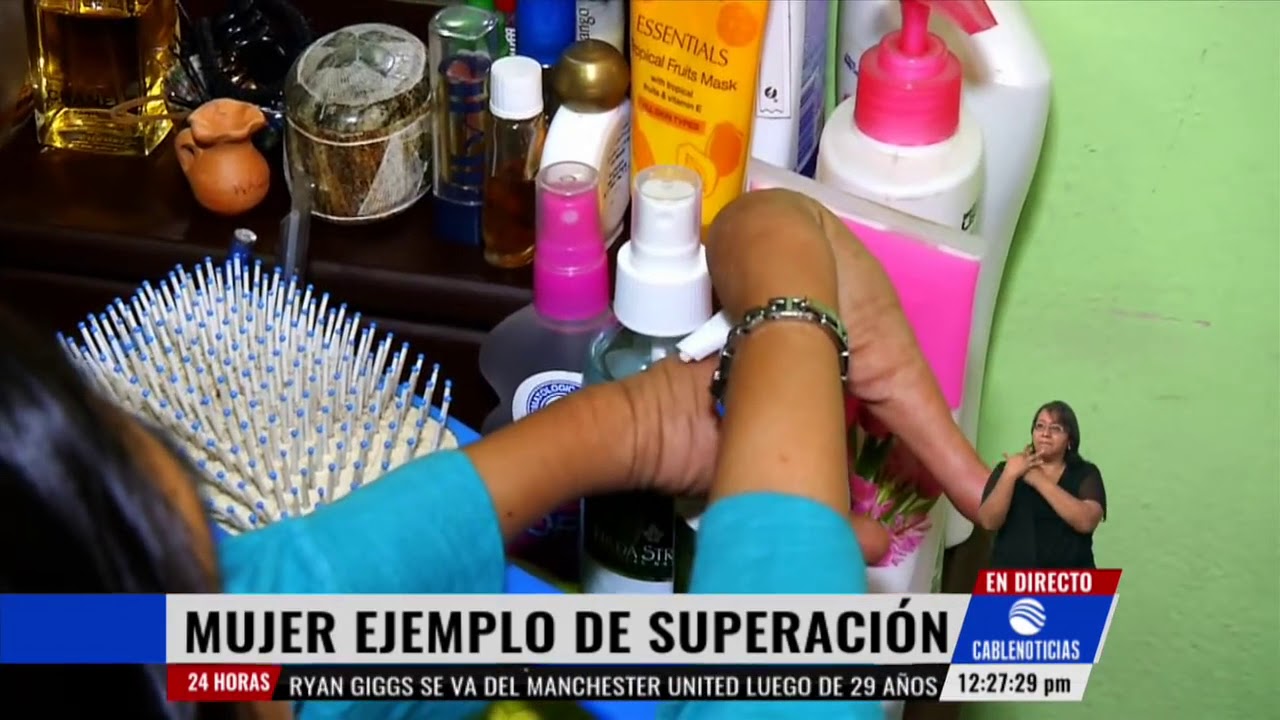 Mujer pese a su discapacidad es toda una superheroína, un ejemplo a seguir