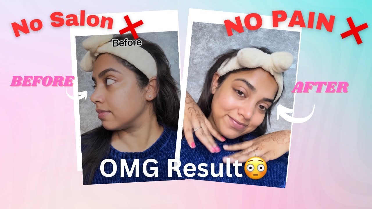 Facial Hair Removal At Home in 5 Minutes 😱 (No Wax , No Pain) #facialhairremoval 