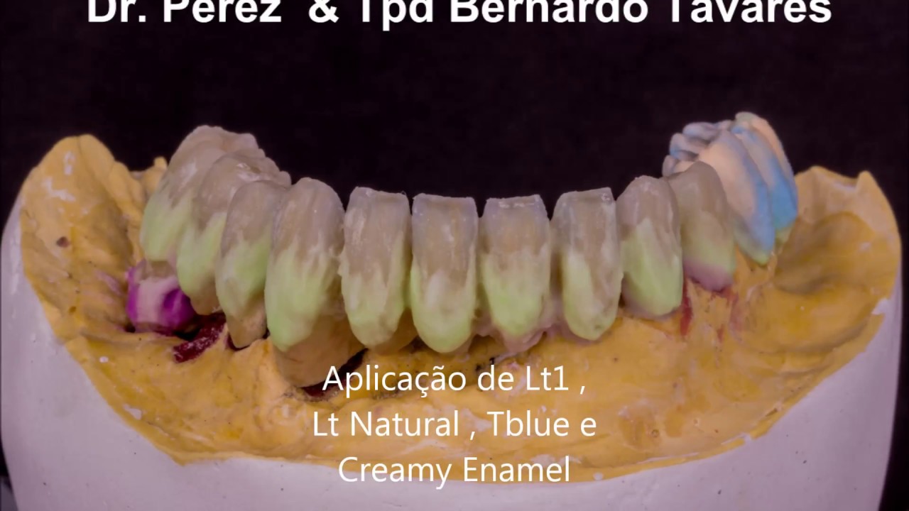 Prótese dentária, aplicação de protocolo cerâmico passo a passo