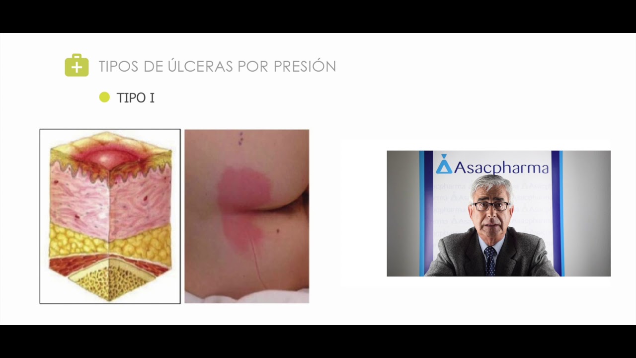 FOR 16 HYPLUS PREVENCIÓN Y AYUDA EN EL TRATAMIENTO DE LAS LESIONES DE LA PIEL LD