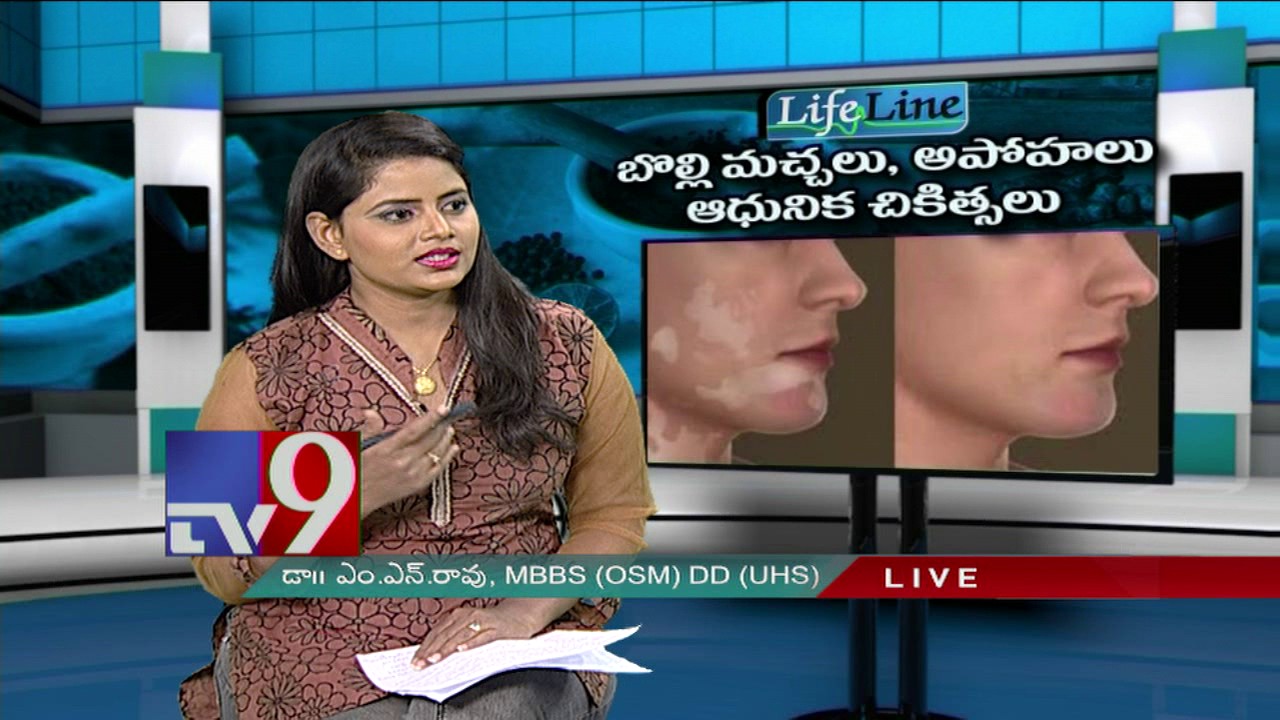 Vitiligo : Latest treatment - Life Line - TV9