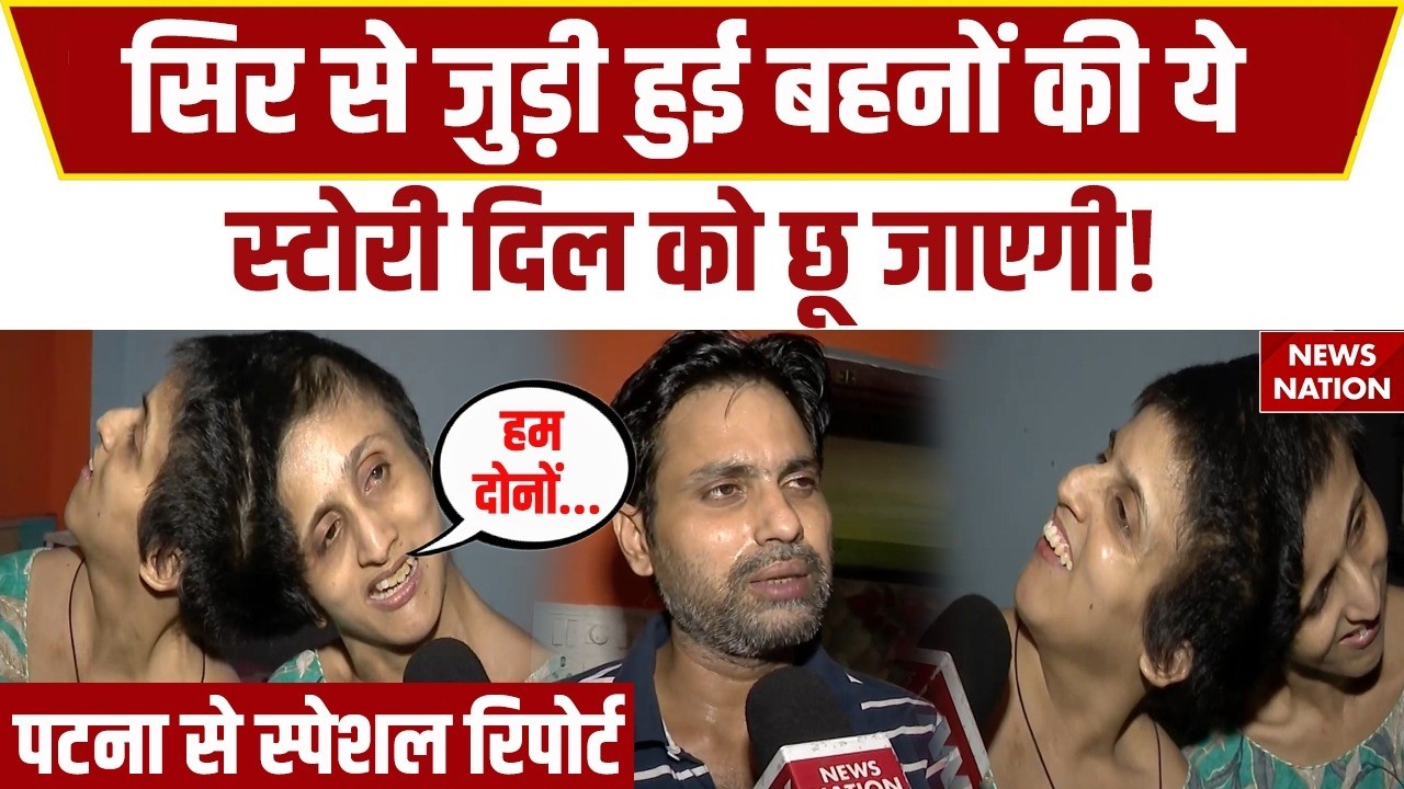 Bihar Conjoined Twins Saba-Farah: Patna में सिर से जुड़ी बहनों की देखिए पूरी कहानी। Medical। Salman