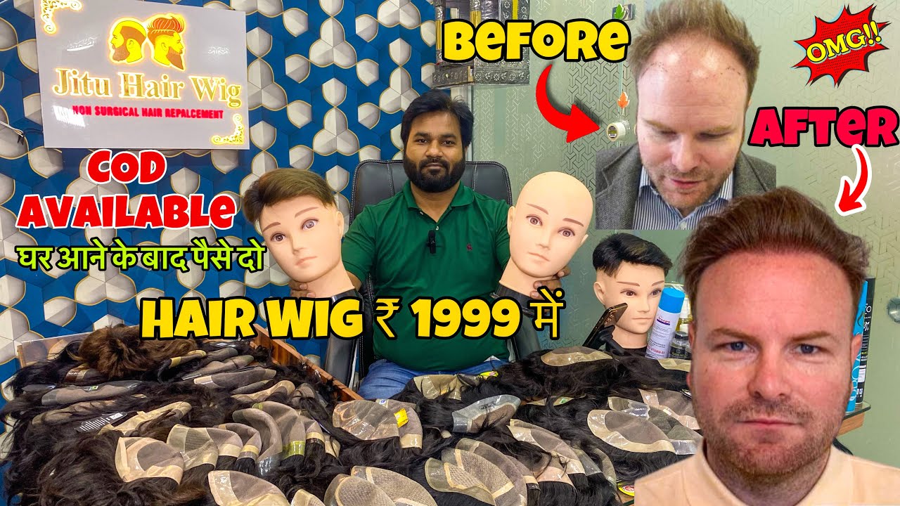 मात्र ₹1999 में Hair wig मँगवाए घर बैठे | Hair Patch Wholesaler & Supplier | hair transplant results