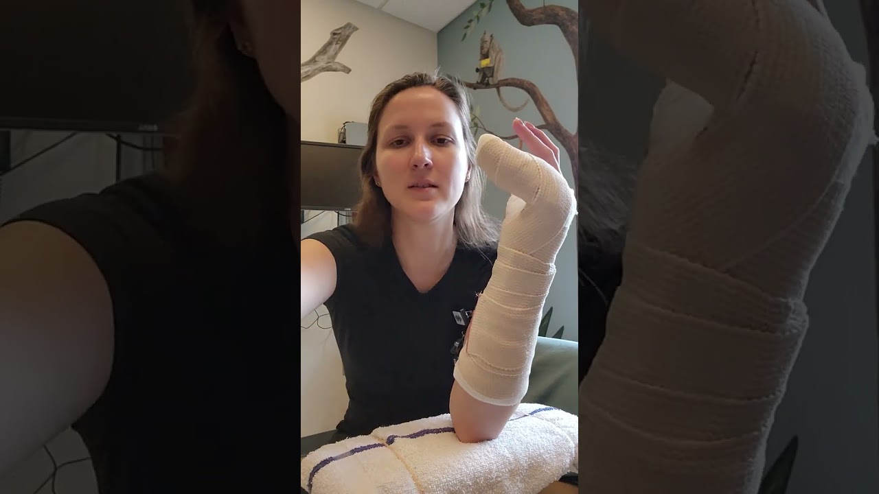 Ulnar Gutter Splint