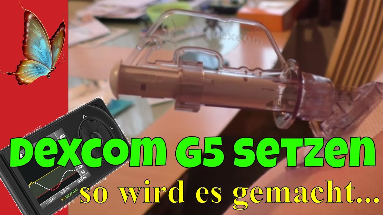 Dexcom G5 Mobile CGM Setzen, Diabetes CGM Dexcom G5 Diabetes Life