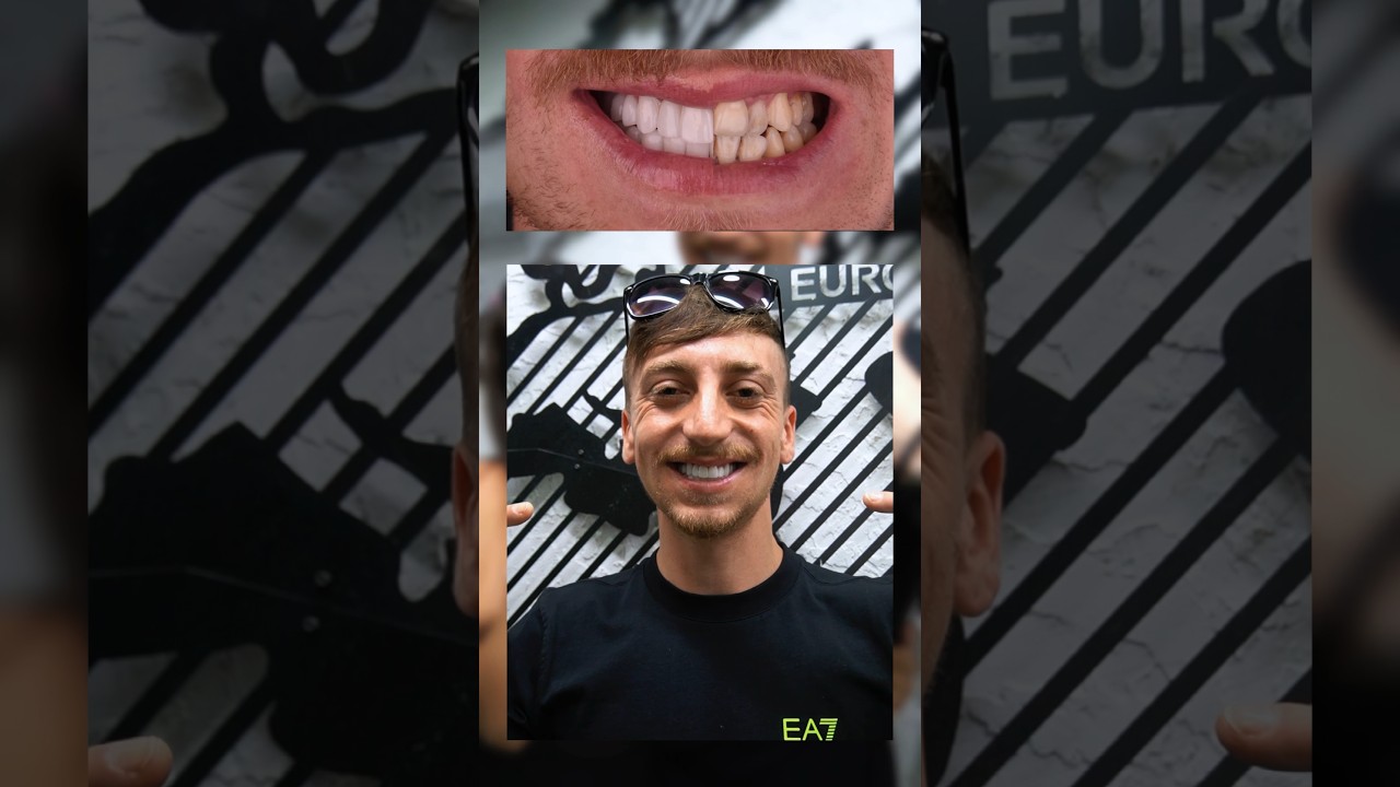Best dentist in Turkey Antalya #dentist #dental #dentalclinicturkey #dentalclinicantalya