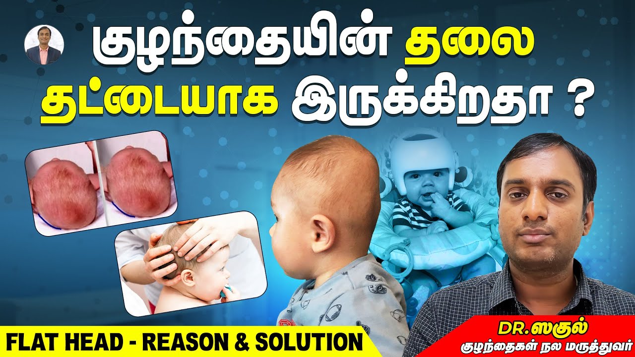 குழந்தையின் தலை தட்டையாக இருக்கிறதா ? | Flat Head - Reason & Solution | Dr Sagul's Paediatric corner