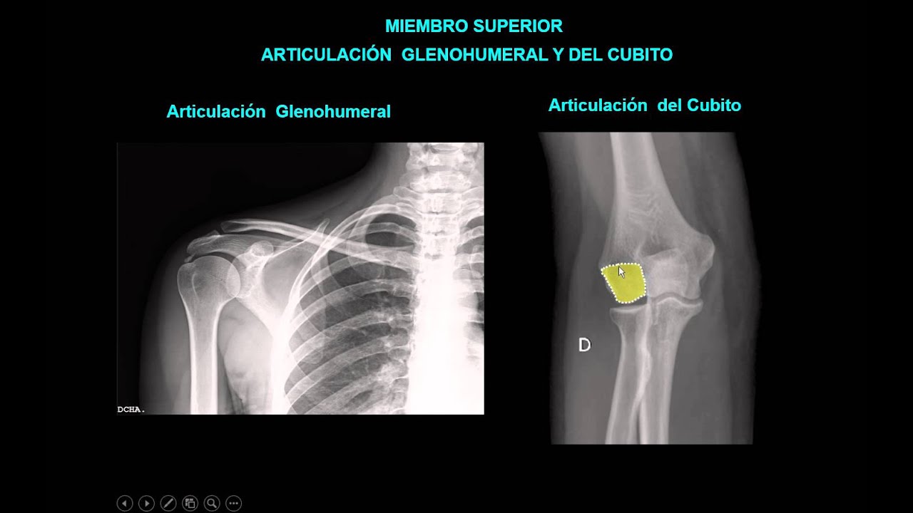 ANATOMIA RADIOLOGICA DEL MIEMBRO SUPERIOR