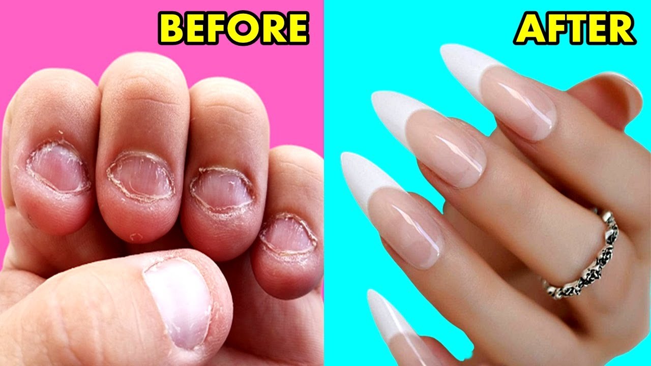 How To GROW Long Strong Nails Fast At Home - DIY Making Nails Strengthener Serum with home materials