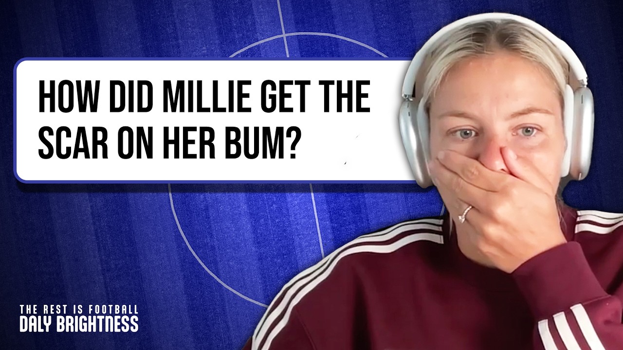 The Scar On Millie's Bum & A Duet In Trafalgar Square