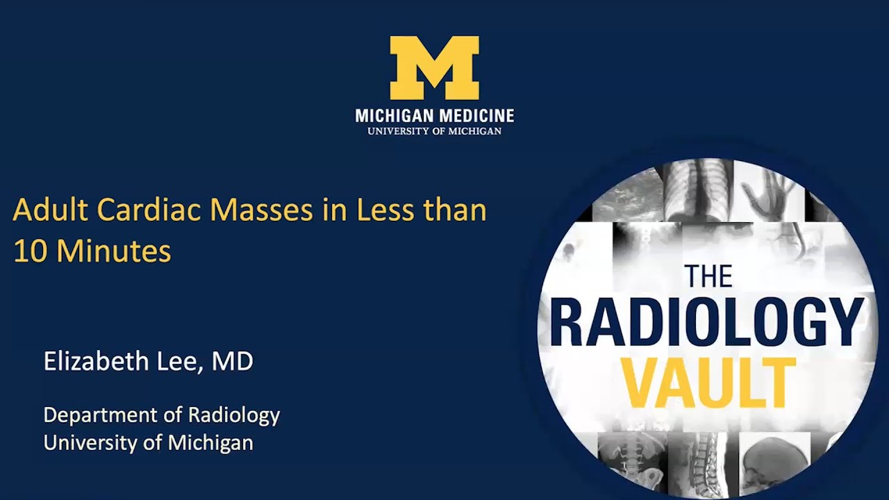 MRI of Cardiac Masses: What Every Radiologist Should Know
