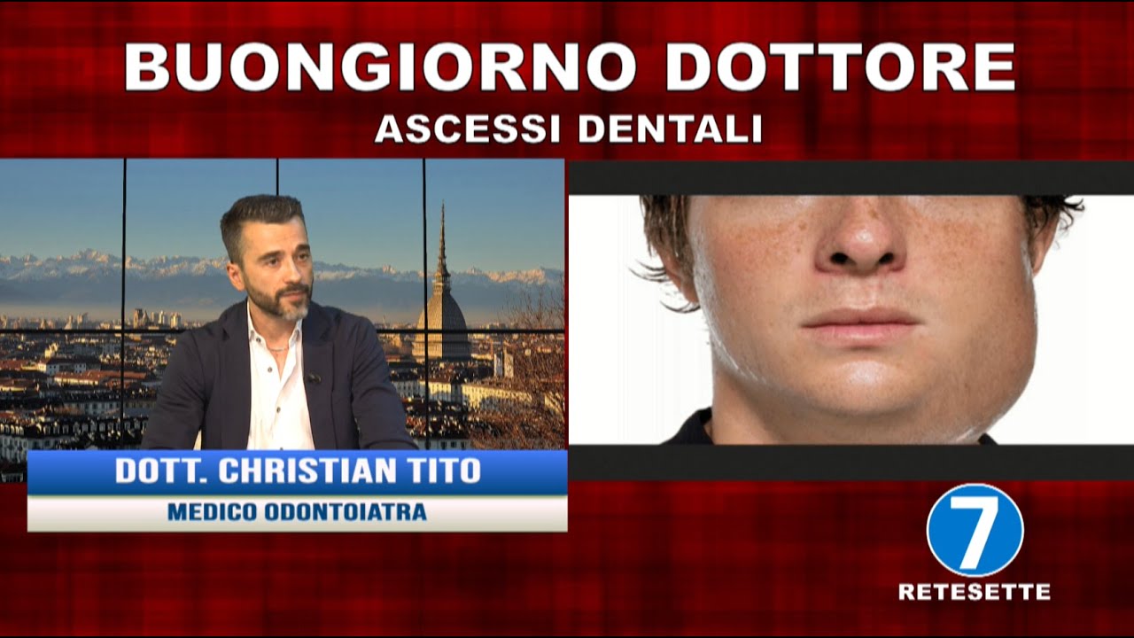 Buongiorno Dottore del 22 giugno 2021 - Ascessi dentali