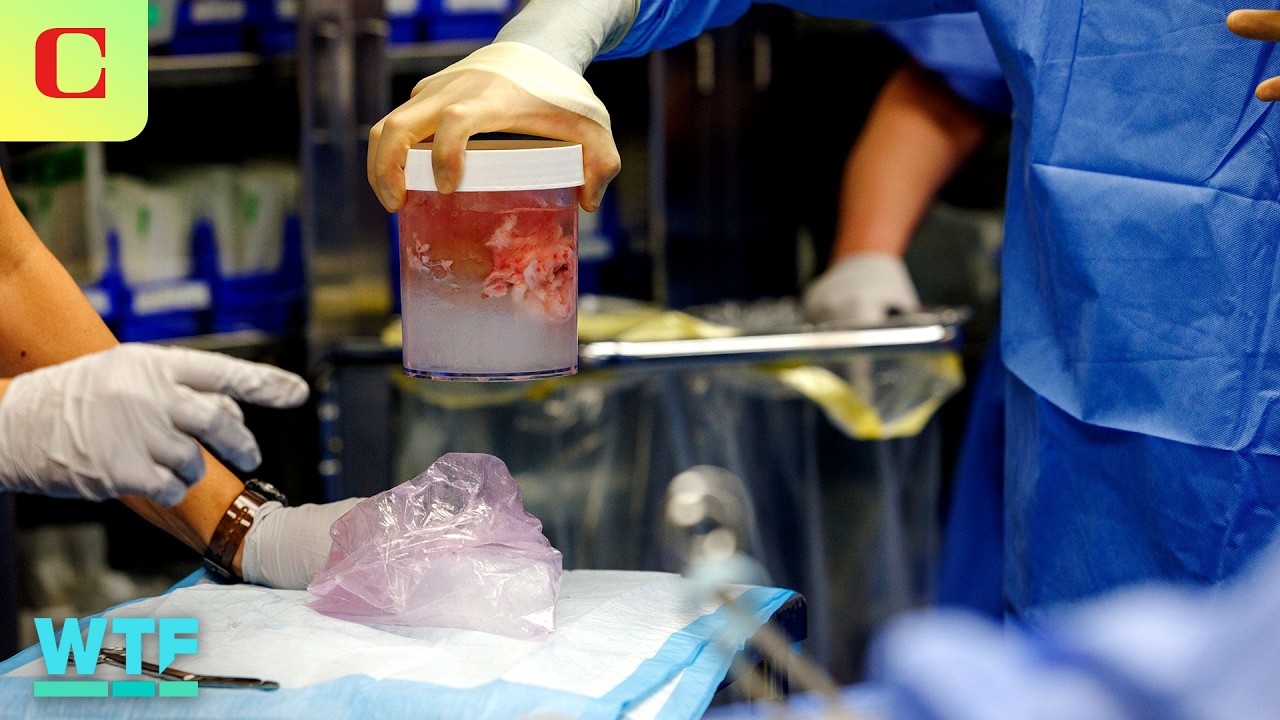Human Receives Gene-edited Pig Kidney from Xenotransplants | What The Future
