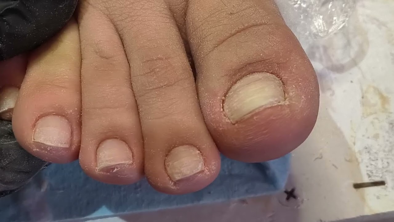 French Rosa en pies 👣