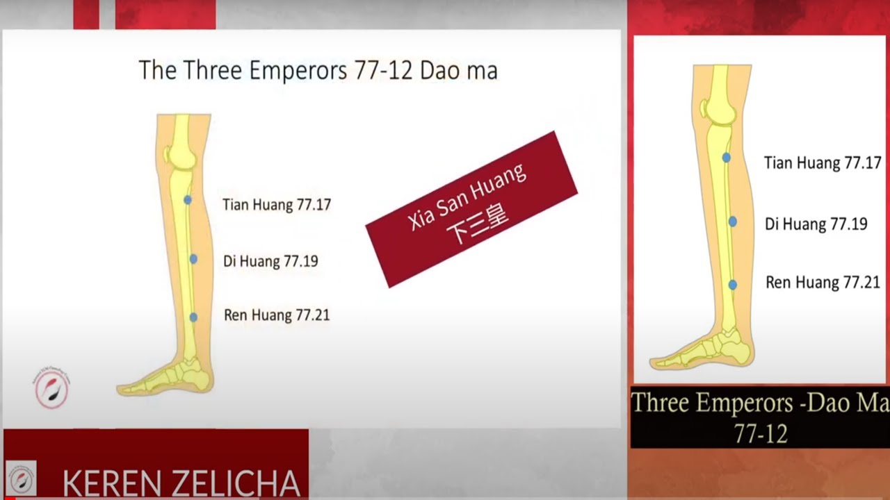 Tung's Acupuncture points- 77.17+ 77.19+ 77.21 (Lower Three Emperors) 【下三皇】
