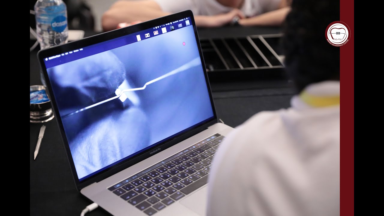 Super advanced orthodontic speciality course, wire bending, digital ortho, Dr. Amr Asker