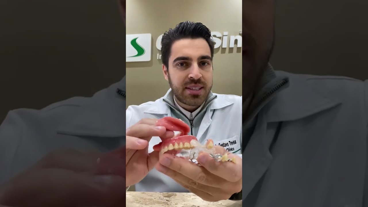 Dentes fixos com implantes dent&aacute;rios.