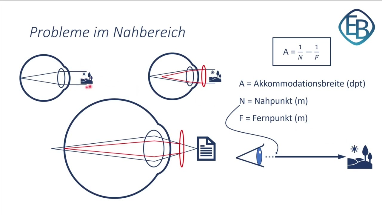 Bildschirmbrille - warum und für wen?