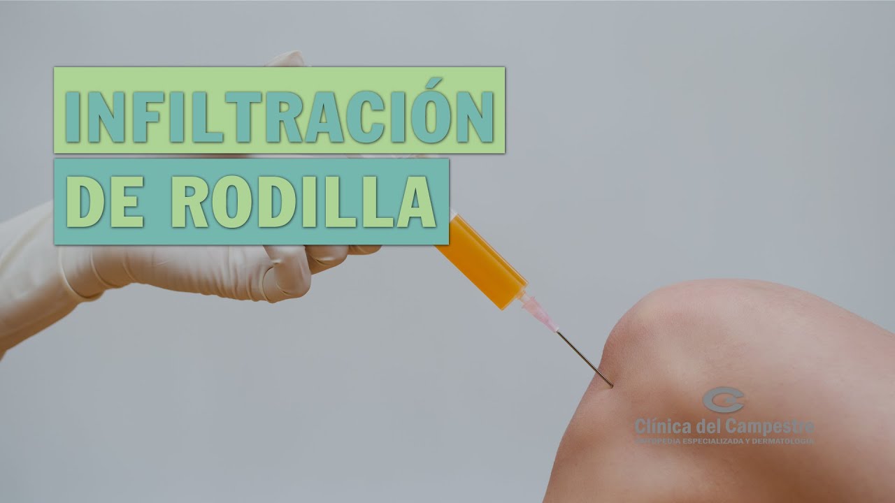 Infiltración de rodilla