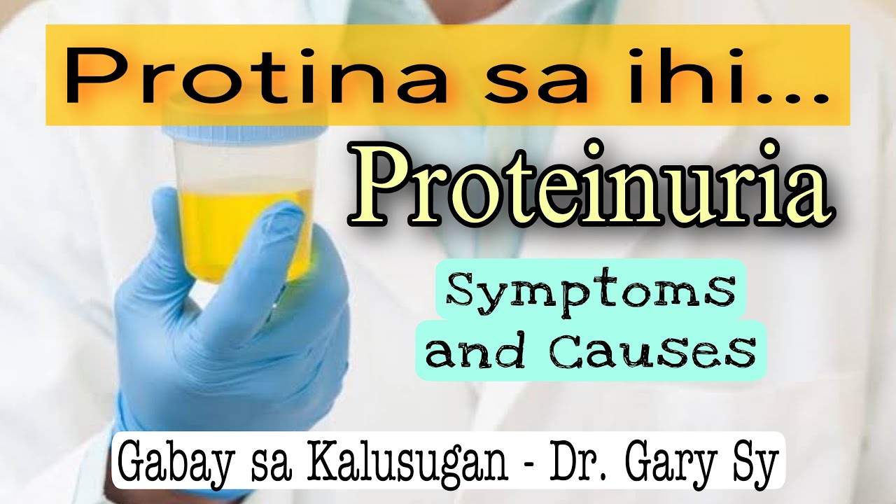 Protein in Urine (Proteinuria) Causes & Symptoms - Dr. Gary Sy