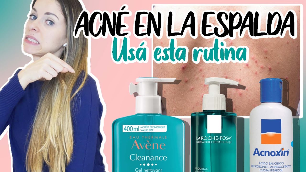Acné y manchas en la espalda? LA SOLUCIÓN