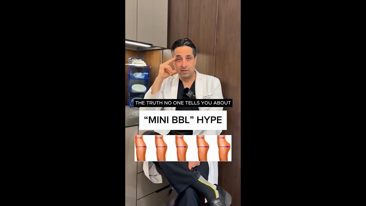 Ever heard of the mini or skinny BBL Let&rsquo;s set the record straight.A Brazilian Butt Lift is NOT