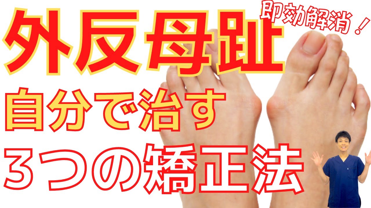 【外反母趾 矯正】サポーター入らず！自分で治す ！ 外反母趾 を 原因 から 治す ３つの 矯正 方法