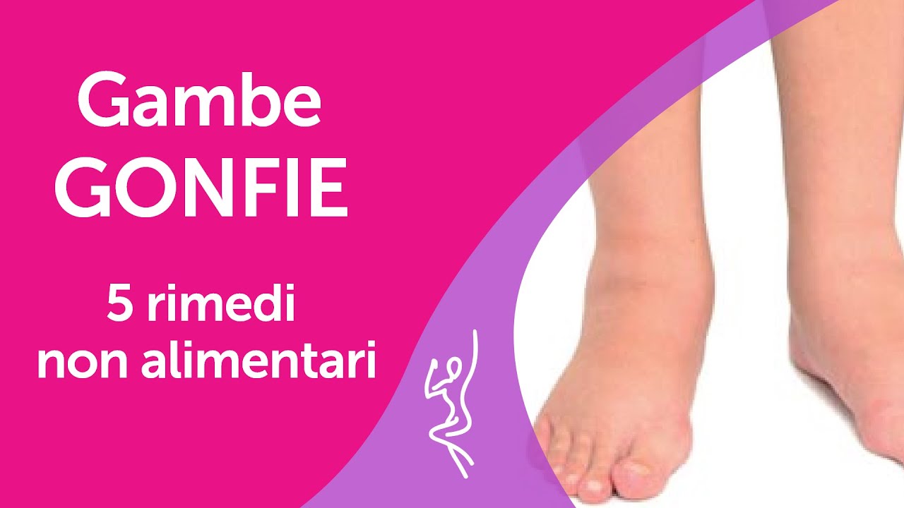 Gambe gonfie 5 rimedi non alimentari