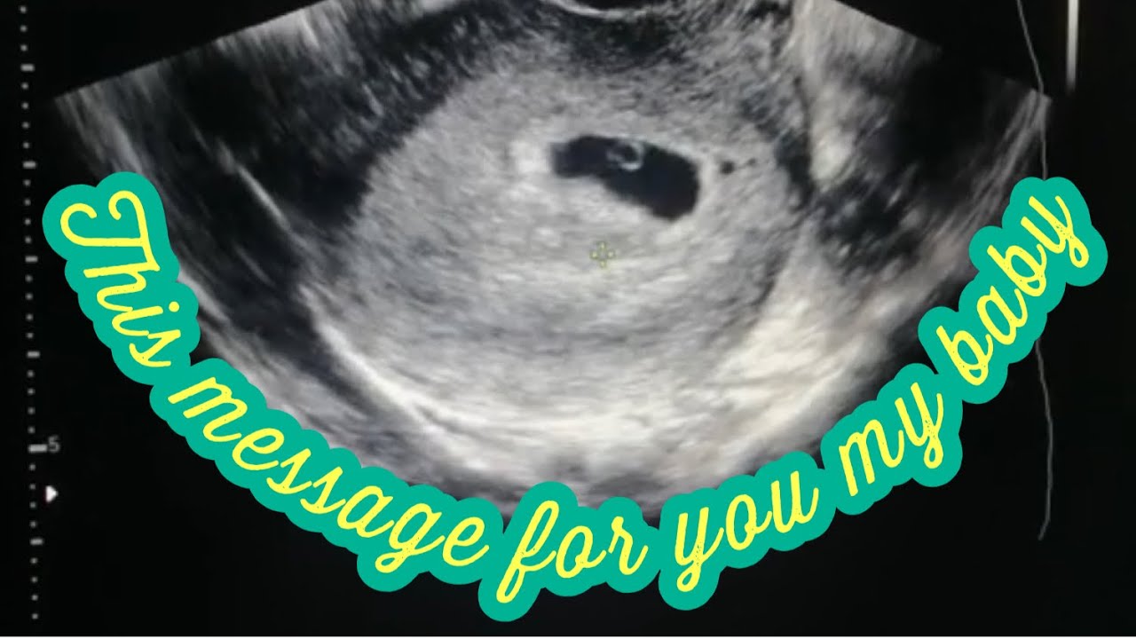 This’s for you ´´ my baby ´´ 💛  (رسالة الى طفلي)