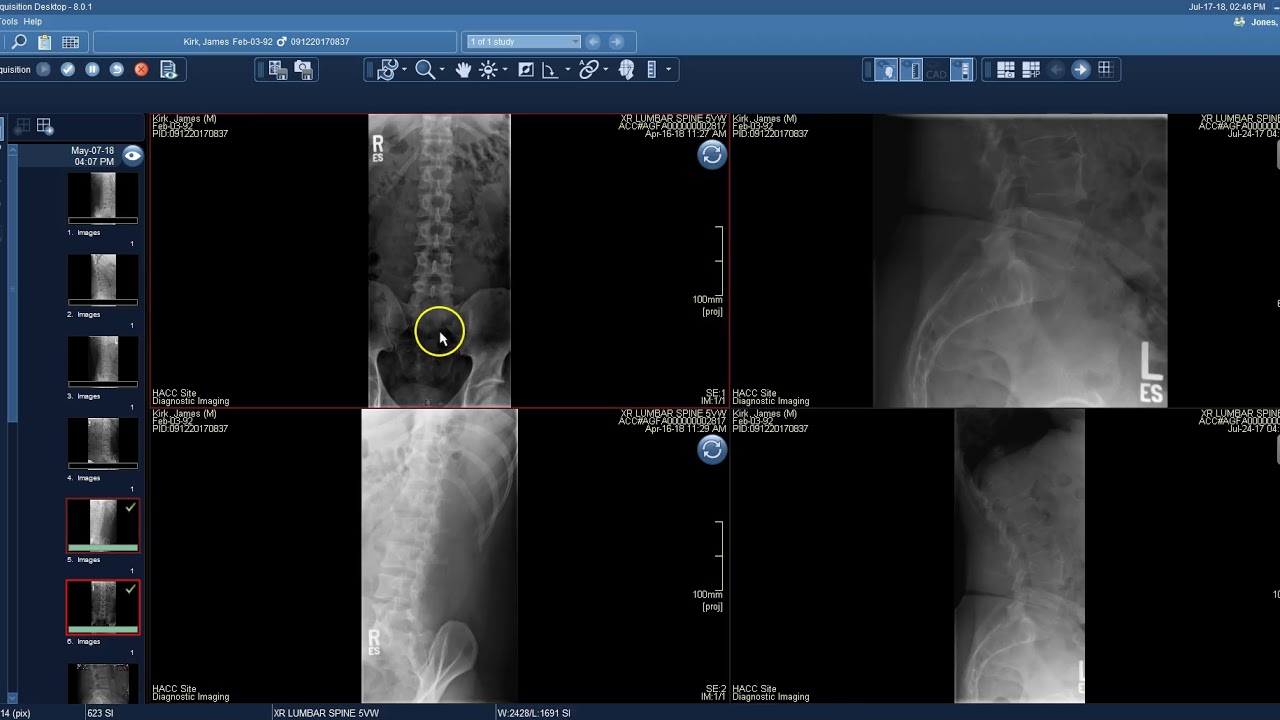 Viewing images in PACS