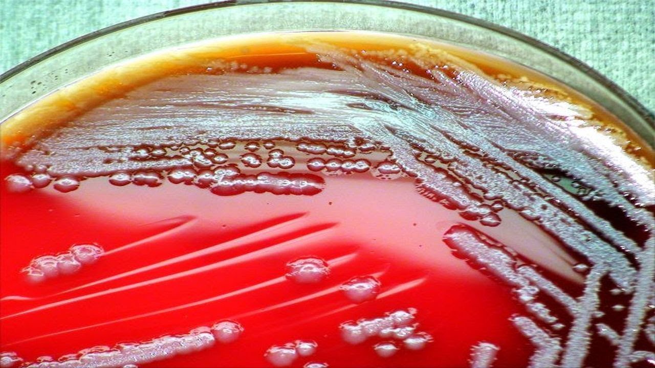 TOP#3 wskazówki, co robić, kiedy infekcje Helicobacter pylori ciągle nawracają (opis pod filmem)...