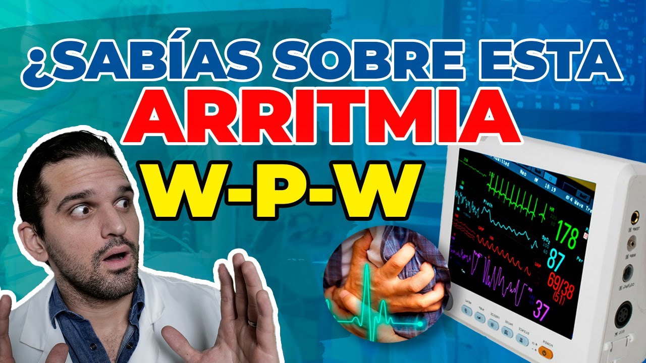 TODO lo que DEBES saber sobre Síndrome de Wolf-Parkinson-White al DESCUBIERTO 👀