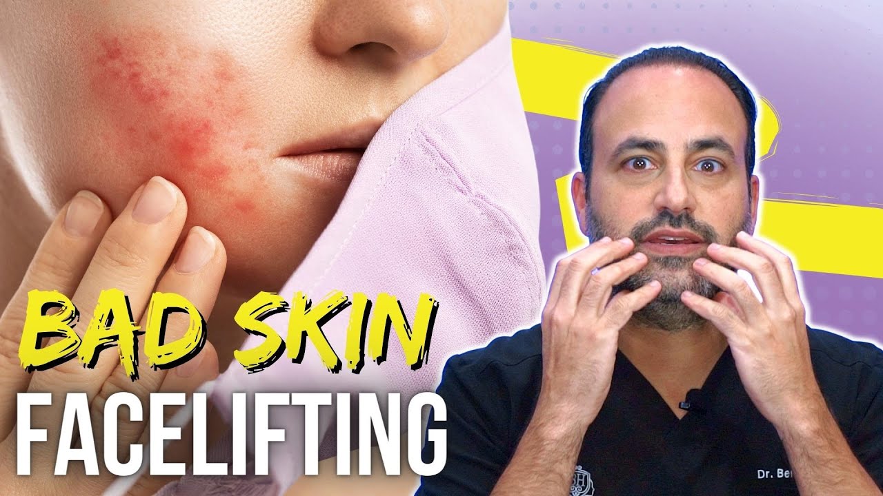 Facelifting with Problematic Skin | Lesson of the Day