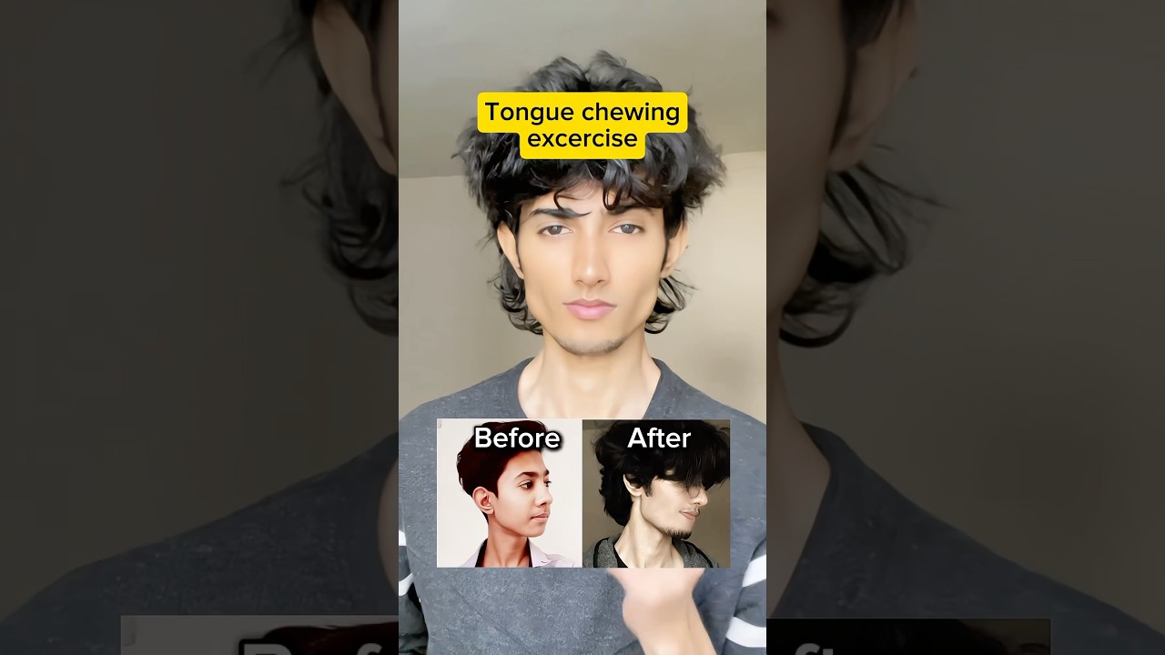 Tounge Chewing + hard Mewing for fast results 😳 #glowup #transformation #jawline #mewing #shorts