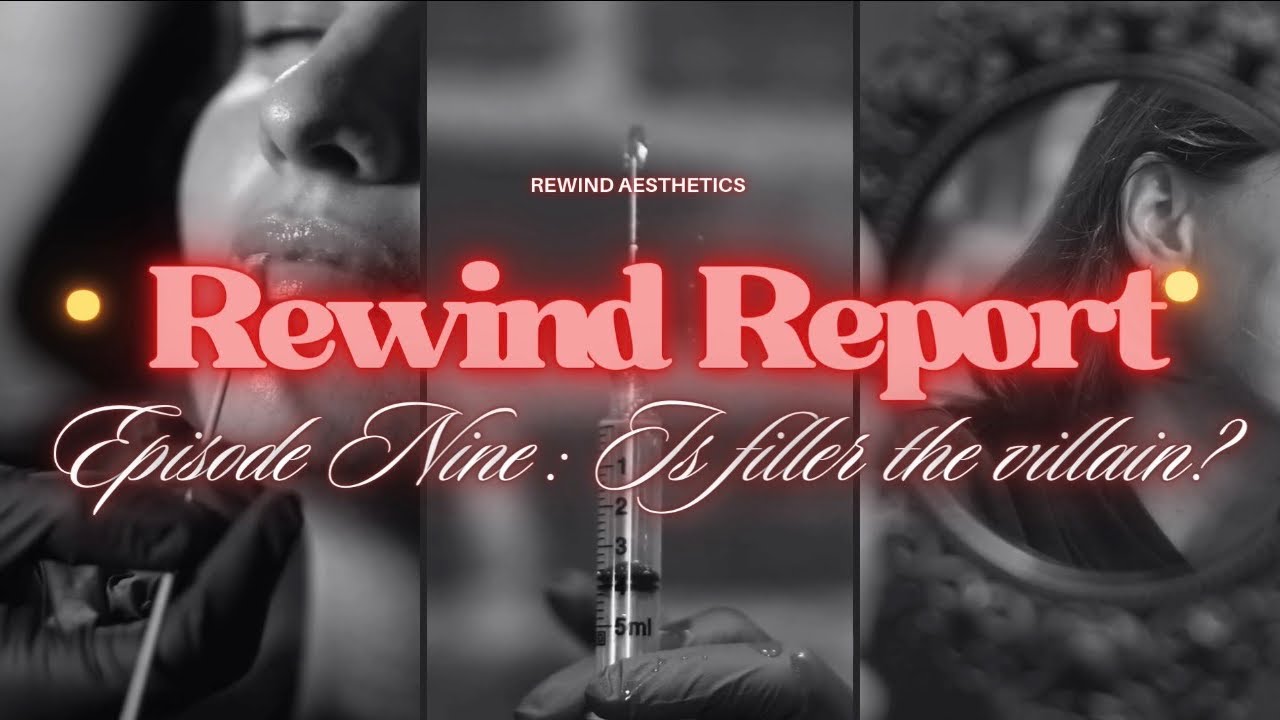 The Rewind Report Episode 9: Is filler really the villain?