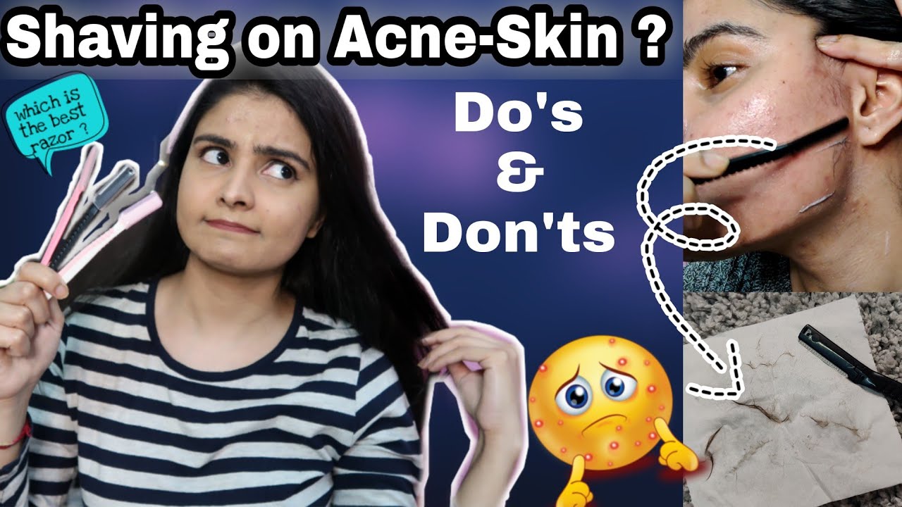 Face Shaving Tutorial on Acne-Prone Skin | Do's & Don'ts | Kashika Chauhan
