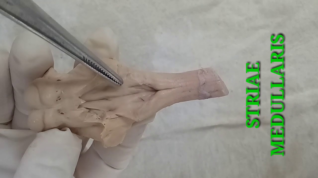 NEUROANATOMY - PONS EXTERNAL FEATURES AND FLOOR OF FOURTH VENTRICLE - BY DR MITESH DAVE
