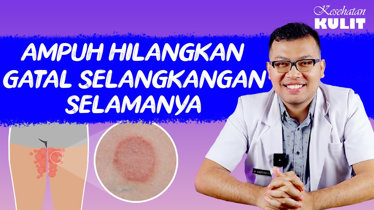 KURAP DISELANGKANGAN YANG BIKIN GATAL - DOKTER SADDAM ISMAIL