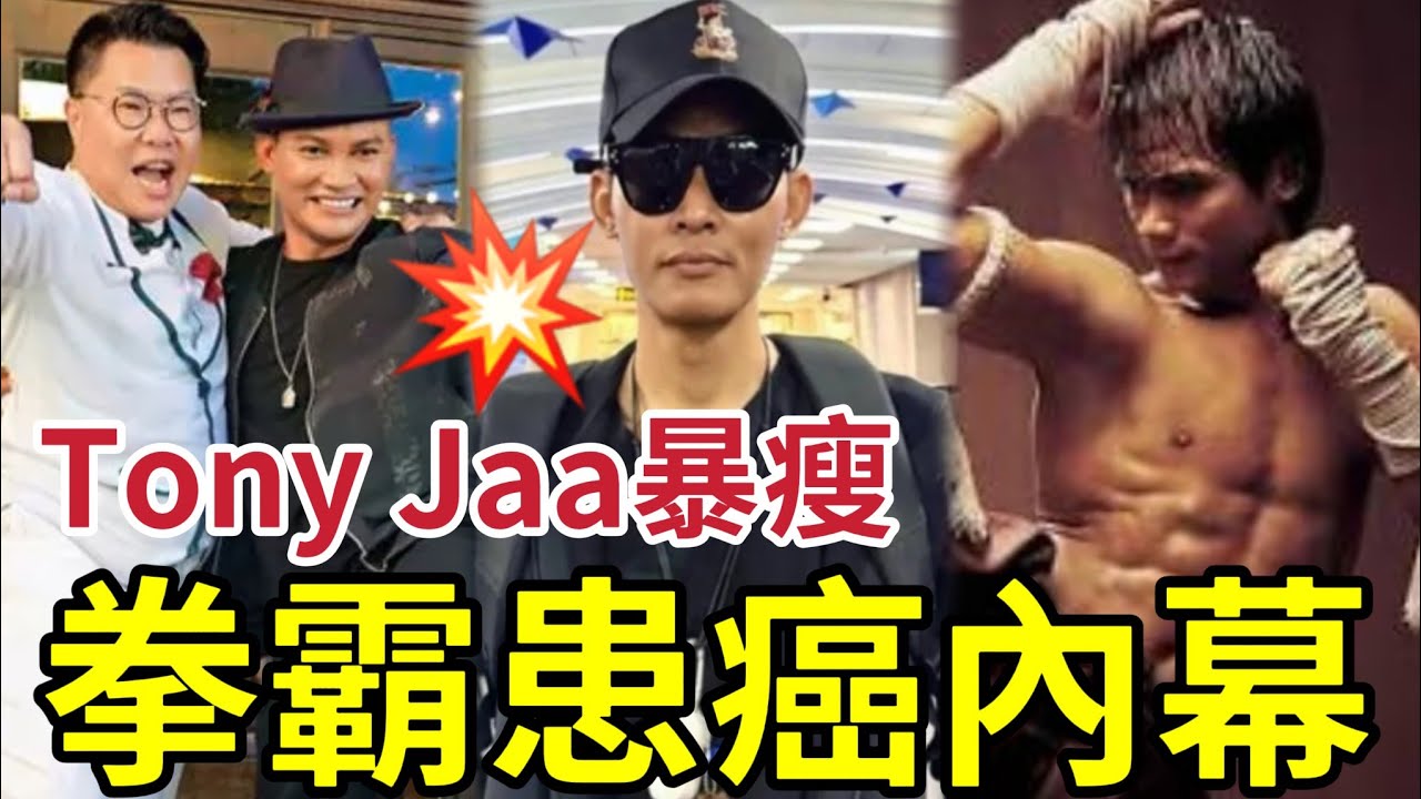 轟動全球！功夫巨星末期癌症！Tong Jaa近況暴瘦「證實患膽囊癌」入院與癌魔博鬥多時！#拳霸 #tonyjaa #胡慧沖