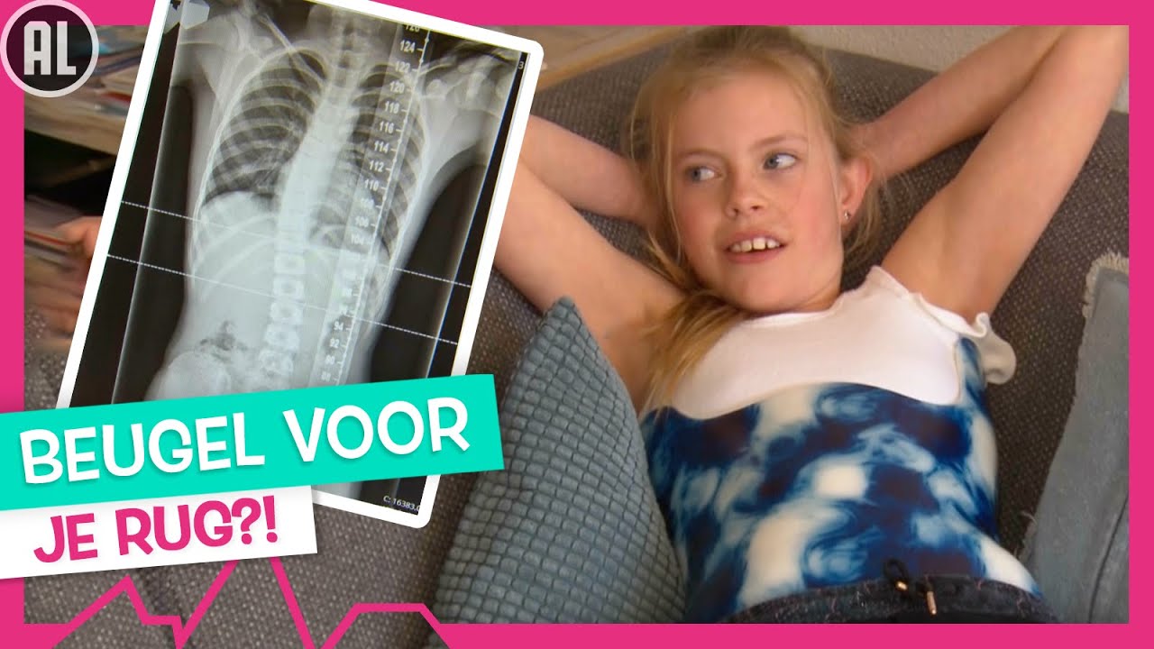 SCOLIOSE: LOÏS KRIJGT EEN BRACE - TOPDOKS
