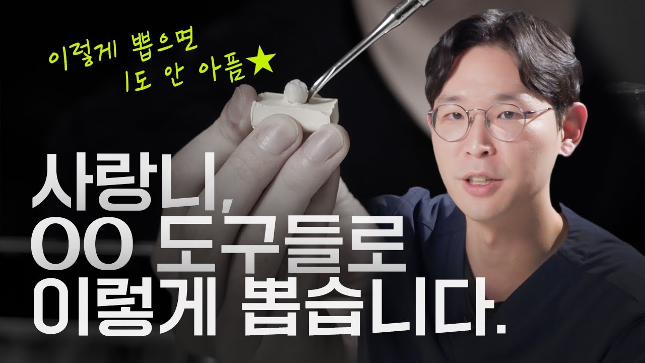 치과의사는 사랑니를 도대체 어떻게 뽑는걸까? | 발치도구 종류와 사용법, 사랑니 발치 과정