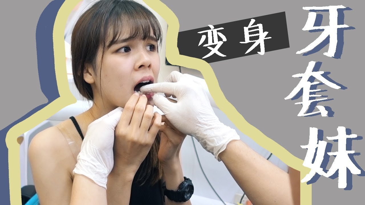 【嘰喳婆】變身成牙套妹了!
