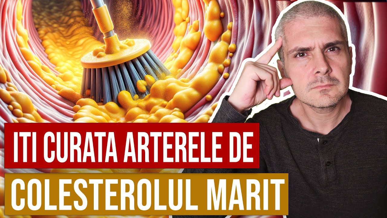 Cum scazi un colesterol marit. Metode naturale eficiente.