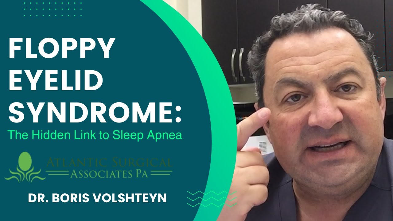 Floppy Eyelid Syndrome: The Hidden Link to Sleep Apnea