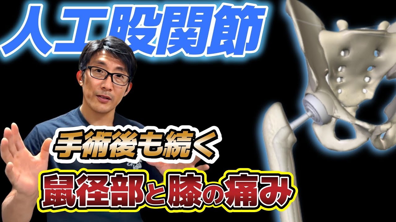人工股関節、術後も続く痛みの対処法！ターゲットは内転筋腱【お悩み相談】
