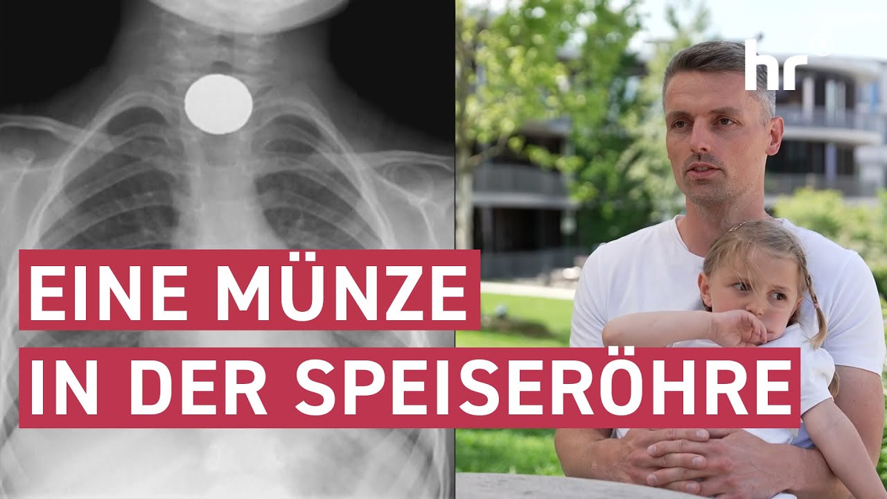 Thea hat eine M&uuml;nze verschluckt | maintower
