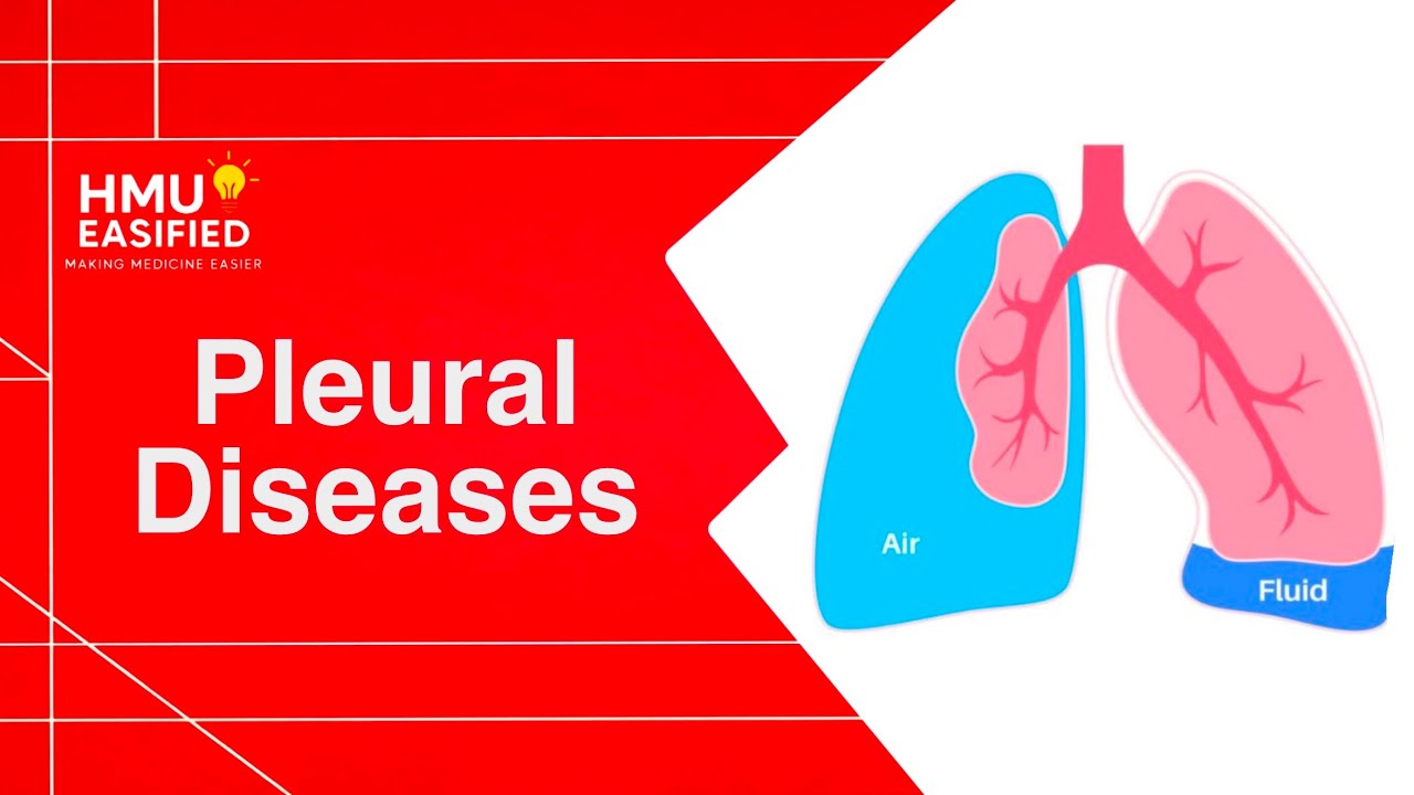 Medicine: Pleural diseases