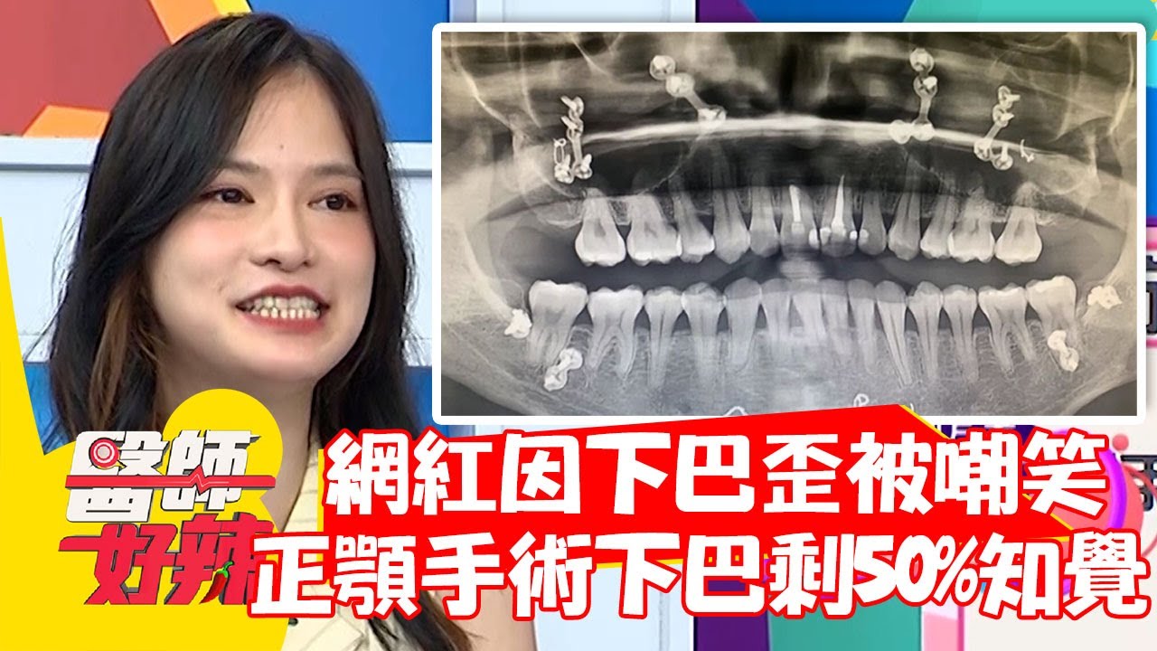 網紅因下巴歪被嘲笑，正顎手術竟造成下巴剩50%知覺？！【#醫師好辣】20211018 part2 EP1219 徐小可 朱育瑩
