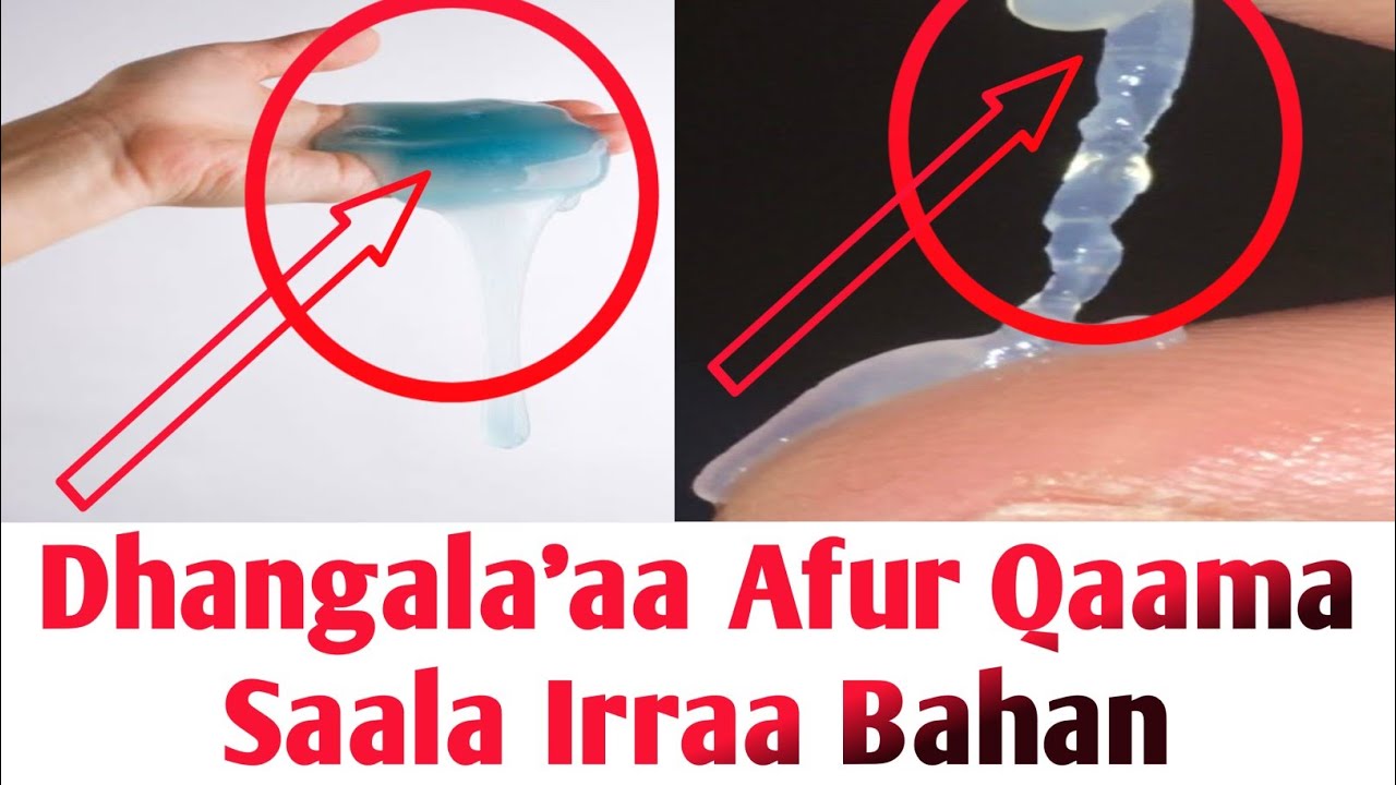 Dhangala'aa Qaama Saala Irraa Bahan fi Akkaataa Qulqullinaa